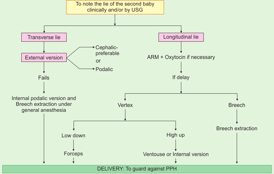 delivery of the second baby