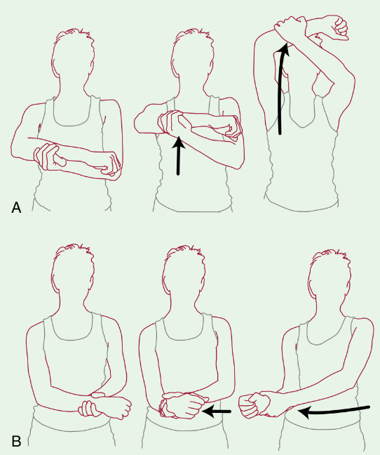 impingement-rehab-phase-i.png