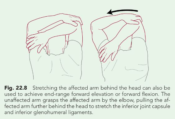 stretch-behind-the-head.png