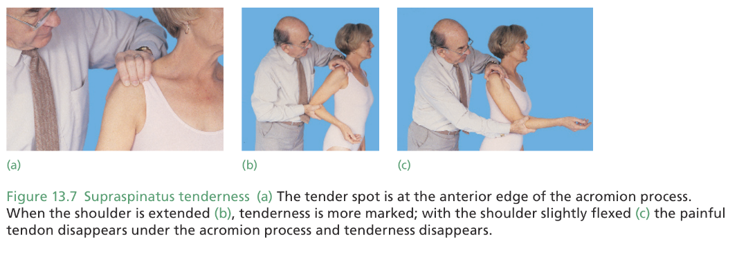 supraspinatus-tenderness.png